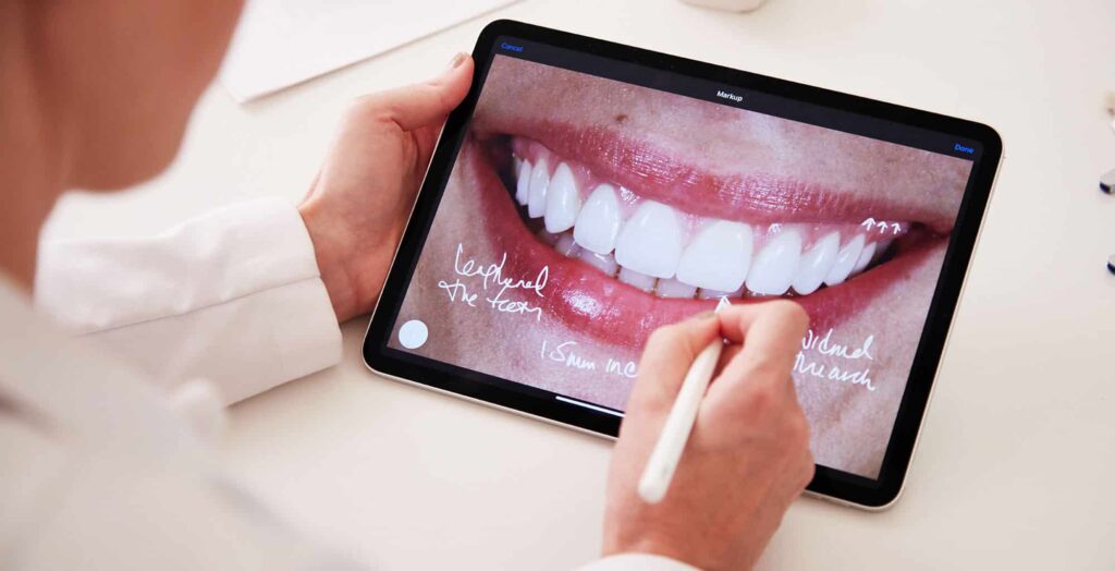 Grand Street Dental Photograph of Doctor reviewing cosmetic case on iPad